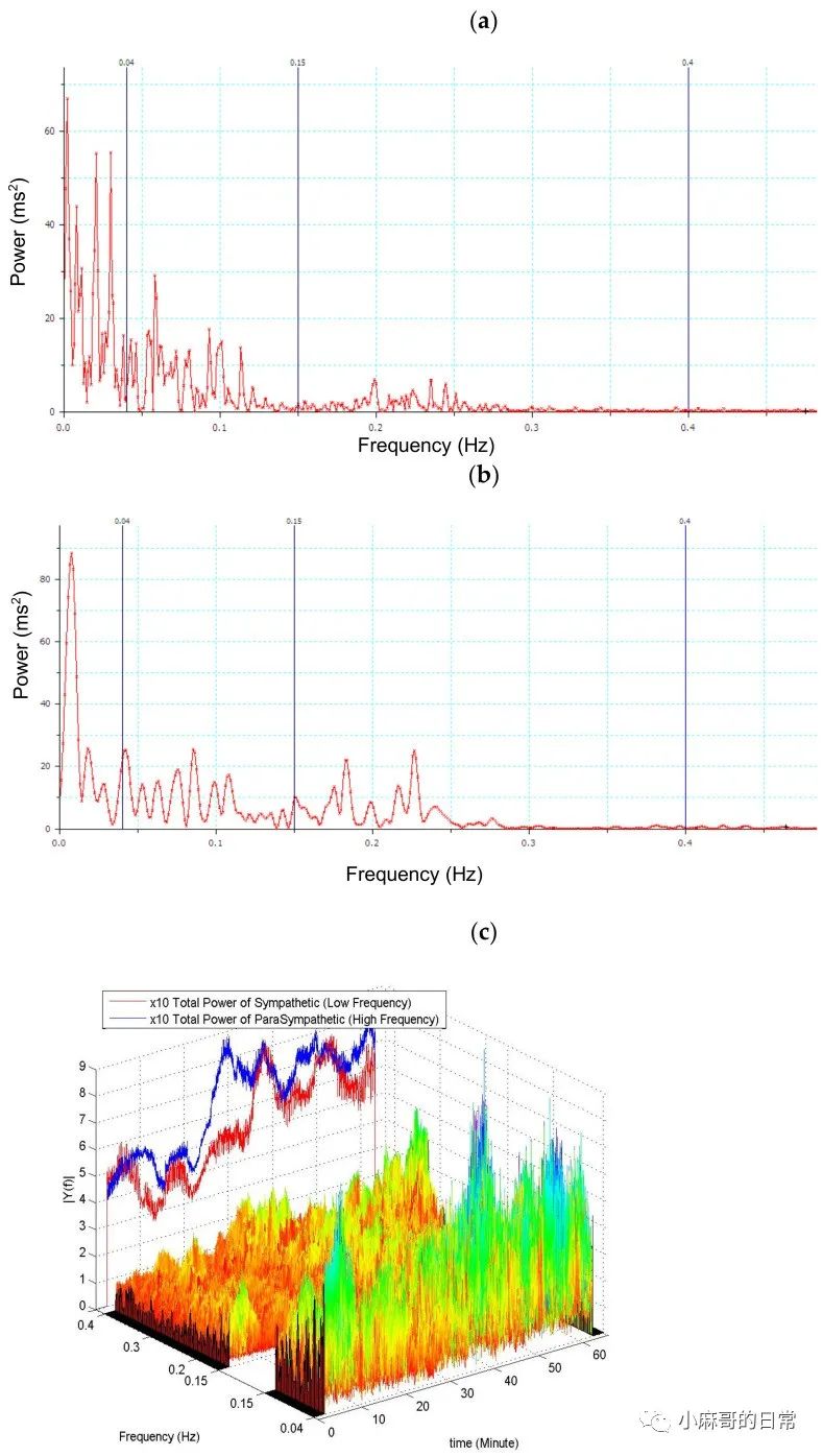 麻醉深度監測：BIS之外(wài)還(hái)可(kě)以用(yòng)的(de)指标是(shì)？(圖2)
