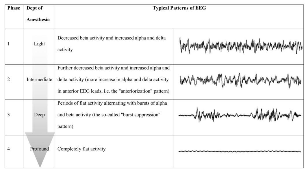 BIS不(bù)準不(bù)等于放(fàng)棄大(dà)腦(nǎo)狀态監測，腦(nǎo)電(diàn)圖在圍術(shù)期的(de)應用(yòng)及意義有(yǒu)哪些(xiē)？(圖2)