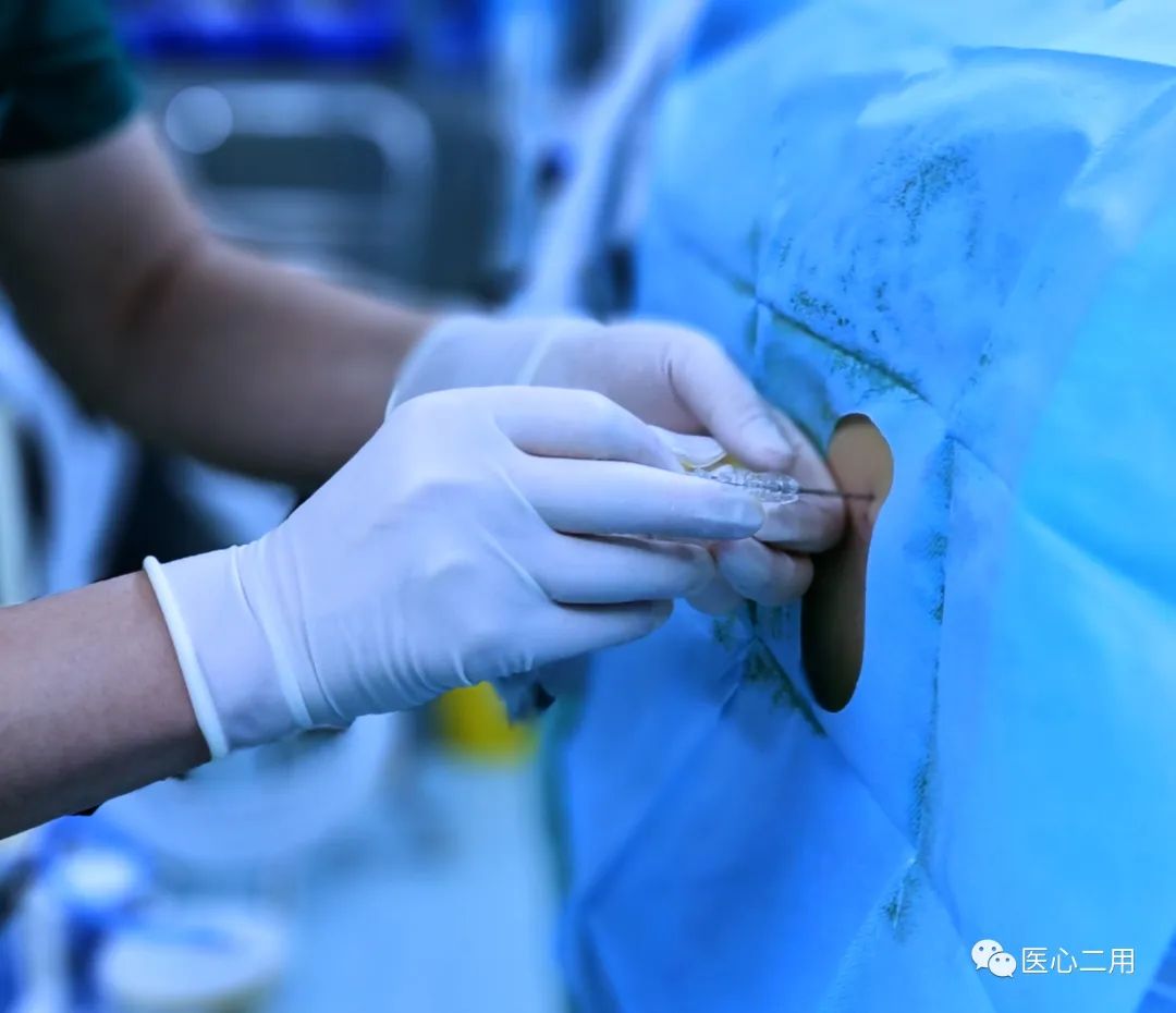 不(bù)要(yào)辯解，麻醉醫(yī)生(shēng)親自(zì)承認，麻醉就(jiù)是(shì)打一(yī)針……(圖3)