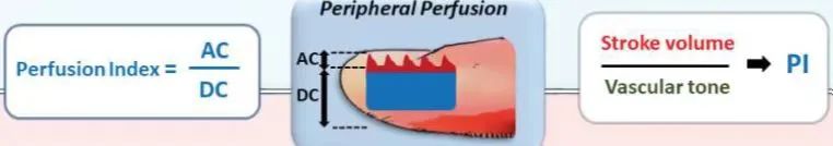 SpO2監測不(bù)僅有(yǒu)數(shù)值，還(hái)有(yǒu)波形(圖1)