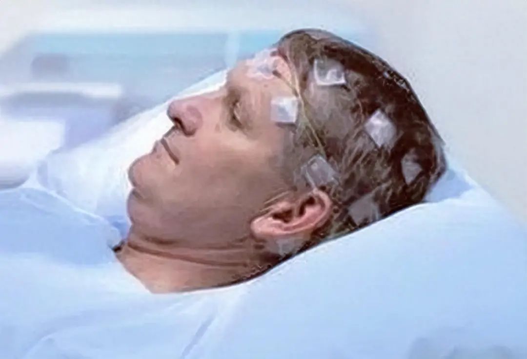 腦(nǎo)氧監測在圍術(shù)期的(de)應用(yòng)(圖1)